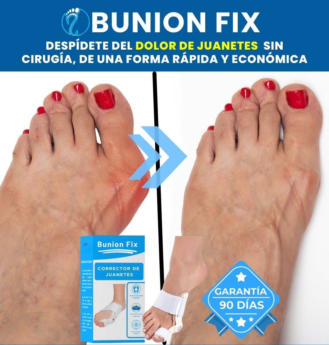 CORRECTOR DE JUANETES